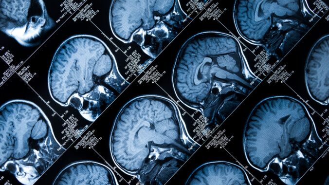 Concussion Litigation: What Neuroscience Tells Us About Brain Injuries